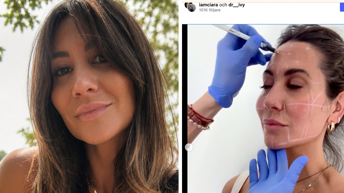 Ciara Janson har genomgått ingrepp