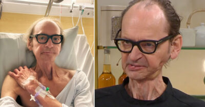 Erik Videgård med glasögon ligger på sjukhus med dropp, jämfört med senare bild där han ser friskare ut